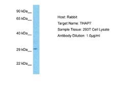 THAP7 Rabbit anti-Human, Polyclonal, Novus Biologicals 0.1 mL | Buy Online | Novus Biologicals | Fisher Scientific